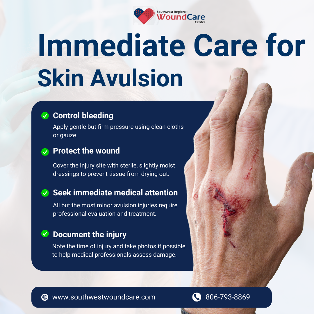 Skin Avulsion Wound Skin Avulsion Wound